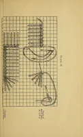 Picture 2 of 11 from A manual of plain needlework and cutting-out (1884), leaf 45