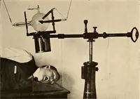 An illustration from A manual of X-ray technic (1917)