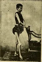 Picture 5 of 52 from Manuel de radioscopie et de radiographie par l'emploi des rayons X (1900), leaf 23
