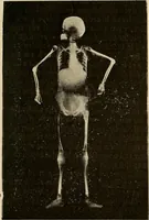 An illustration from Manuel de radioscopie et de radiographie par l'emploi des rayons X (1900)