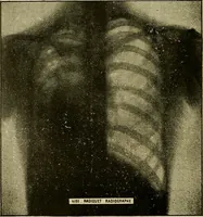 An illustration from Manuel de radioscopie et de radiographie par l'emploi des rayons X (1900)