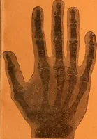 An illustration from Manuel de radioscopie et de radiographie par l'emploi des rayons X (1900)