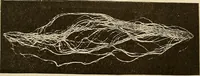 Picture 18 of 52 from Manuel de radioscopie et de radiographie par l'emploi des rayons X (1900), leaf 42