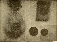 Picture 35 of 52 from Manuel de radioscopie et de radiographie par l'emploi des rayons X (1900), leaf 66