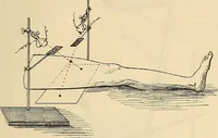 An illustration from Manuel de radioscopie et de radiographie par l'emploi des rayons X (1900)