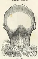 Picture 3 of 12 from Marriage : its history and ceremonies : with a phrenological and physiological exposition of the functions and qualifications for happy marriages (1847), leaf 91