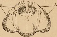 Picture 6 of 34 from Marvels of pond-life; or, A year's microscopic recreations among the polyps, infusoria, rotifers, water-bears and polyzoa (1871), leaf 45