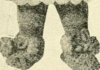 Picture 99 of 266 from The Mary Frances knitting and crocheting book; (1918), leaf 102