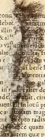 An illustration from Medicae artis principes, post Hippocratem & Galenum. Graeci Latinitate donati, Aretaeus, Ruffus Ephesius, Oribasius, Paulus Aegineta, Aëtius, Alex. Trallianus, Actuarius, Nic. Myrepsus. Latini, Corn. Celsus, Scrib. Largus, Marcell. Empiricus. Aliíque praeterea, quorum unius nomen ignoratur. Index non solùm copiosus, sed etiam ordine artificioso omnia digesta habens. Hippocr. aliquot loci cum Corn. Celsi interpretatione (1567)