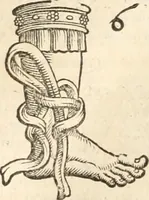 An illustration from Medicae artis principes, post Hippocratem & Galenum. Graeci Latinitate donati, Aretaeus, Ruffus Ephesius, Oribasius, Paulus Aegineta, Aëtius, Alex. Trallianus, Actuarius, Nic. Myrepsus. Latini, Corn. Celsus, Scrib. Largus, Marcell. Empiricus. Aliíque praeterea, quorum unius nomen ignoratur. Index non solùm copiosus, sed etiam ordine artificioso omnia digesta habens. Hippocr. aliquot loci cum Corn. Celsi interpretatione (1567)