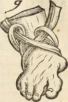 An illustration from Medicae artis principes, post Hippocratem & Galenum. Graeci Latinitate donati, Aretaeus, Ruffus Ephesius, Oribasius, Paulus Aegineta, Aëtius, Alex. Trallianus, Actuarius, Nic. Myrepsus. Latini, Corn. Celsus, Scrib. Largus, Marcell. Empiricus. Aliíque praeterea, quorum unius nomen ignoratur. Index non solùm copiosus, sed etiam ordine artificioso omnia digesta habens. Hippocr. aliquot loci cum Corn. Celsi interpretatione (1567)