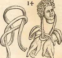 Picture 15 of 57 from Medicae artis principes, post Hippocratem & Galenum. Graeci Latinitate donati, Aretaeus, Ruffus Ephesius, Oribasius, Paulus Aegineta, Aëtius, Alex. Trallianus, Actuarius, Nic. Myrepsus. Latini, Corn. Celsus, Scrib. Largus, Marcell. Empiricus. Aliíque praeterea, quorum unius nomen ignoratur. Index non solùm copiosus, sed etiam ordine artificioso omnia digesta habens. Hippocr. aliquot loci cum Corn. Celsi interpretatione (1567), leaf 87