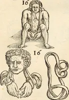 Picture 18 of 57 from Medicae artis principes, post Hippocratem & Galenum. Graeci Latinitate donati, Aretaeus, Ruffus Ephesius, Oribasius, Paulus Aegineta, Aëtius, Alex. Trallianus, Actuarius, Nic. Myrepsus. Latini, Corn. Celsus, Scrib. Largus, Marcell. Empiricus. Aliíque praeterea, quorum unius nomen ignoratur. Index non solùm copiosus, sed etiam ordine artificioso omnia digesta habens. Hippocr. aliquot loci cum Corn. Celsi interpretatione (1567), leaf 87