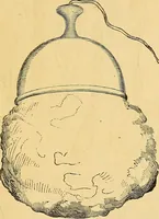 Picture 45 of 54 from The medical application of electricity (1860), leaf 278
