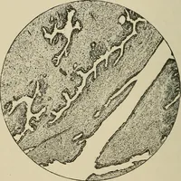 An illustration from Medical microscopy : a guide to the use of the microscope in medical practice (1898)