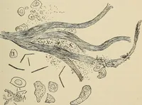 An illustration from Medical microscopy : a guide to the use of the microscope in medical practice (1898)