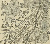 An illustration from Medical microscopy : a guide to the use of the microscope in medical practice (1898)