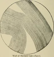 Picture 57 of 81 from Medical microscopy : a guide to the use of the microscope in medical practice (1898), leaf 325