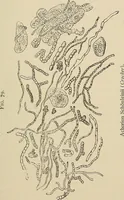 An illustration from Medical microscopy : a guide to the use of the microscope in medical practice (1898)
