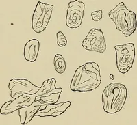 An illustration from Medical microscopy : a guide to the use of the microscope in medical practice (1898)