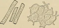 An illustration from Medical microscopy : a guide to the use of the microscope in medical practice (1898)