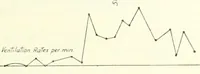 Picture 1 of 3 from The medical problems of flying, including reports nos. 1-7 of the Air medical investigation committee (1920), leaf 49