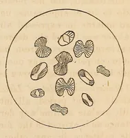 An illustration from The Medical and surgical reporter (1858)