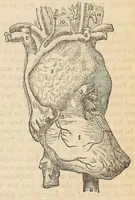 An illustration from The Medical and surgical reporter (1858)