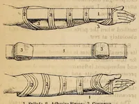 An illustration from The Medical and surgical reporter (1858)