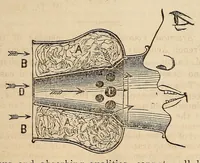 An illustration from The Medical and surgical reporter (1858)