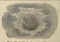An illustration from The Medical and surgical reporter (1858)