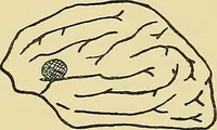 An illustration from Medicine and the mind : (la medecine de l'esprit) (1900)