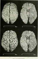 Picture 7 of 89 from Memoirs (1783), leaf 158
