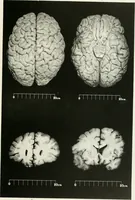 Picture 9 of 89 from Memoirs (1783), leaf 162