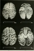 Picture 11 of 89 from Memoirs (1783), leaf 166