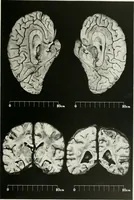 Picture 14 of 89 from Memoirs (1783), leaf 172