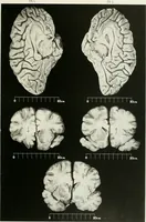 Picture 19 of 89 from Memoirs (1783), leaf 182
