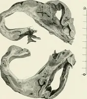 An illustration from Memoirs (1783)