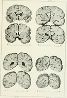 Picture 38 of 89 from Memoirs (1783), leaf 296