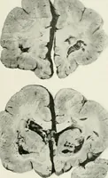 Picture 41 of 89 from Memoirs (1783), leaf 302