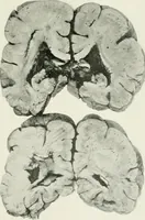 An illustration from Memoirs (1783)