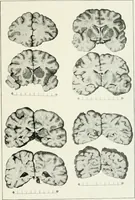 Picture 46 of 89 from Memoirs (1783), leaf 306