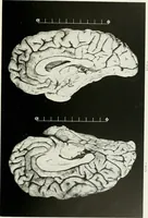 Picture 47 of 89 from Memoirs (1783), leaf 308