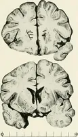 An illustration from Memoirs (1783)