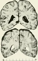 An illustration from Memoirs (1783)