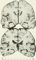 An illustration from Memoirs (1783)