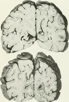 An illustration from Memoirs (1783)