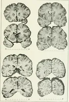 An illustration from Memoirs (1783)