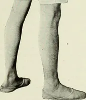 An illustration from Men's wear of Canada (January-December 1922) (1922)