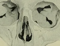 An illustration from The mental functions of the brain : an investigation into their localisation and their manifestation in health and disease (1901)